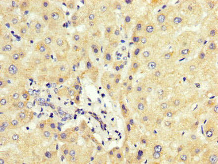 IHC image of PCBP2 Antibody diluted at 1:200 and staining in paraffin-embedded human liver tissue performed on a Leica BondTM system. After dewaxing and hydration, antigen retrieval was mediated by high pressure in a citrate buffer (pH 6.0). Section was blocked with 10% normal goat serum 30min at RT. Then primary antibody (1% BSA) was incubated at 4°C overnight. The primary is detected by a biotinylated secondary antibody and visualized using an HRP conjugated SP system.Rabbit anti-Human PCBP2 Polyclonal Antibody