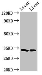 Western Blot | Positive WB detected in: Rat liver tissue, Mouse liver tissue | All lanes: RGN antibody at 3μg/ml | Secondary | Goat polyclonal to rabbit IgG at 1/50000 dilution | Predicted band size: 34, 25 kDa | Observed band size: 34 kDa