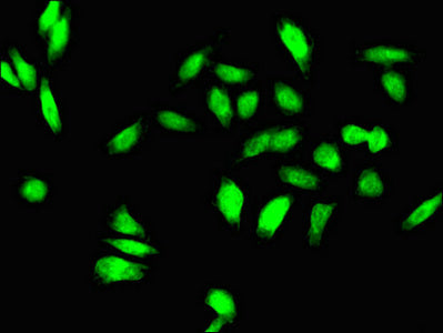 Immunofluorescent analysis of Hela cells using TGIF1 Antibody at dilution of 1:100 and Alexa Fluor 488-congugated AffiniPure Goat Anti-Rabbit IgG(H+L)Rabbit anti-Human TGIF1 Polyclonal Antibody