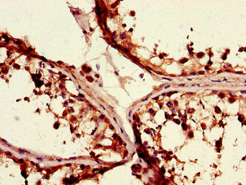 Immunohistochemistry of paraffin-embedded human testis tissue using TGIF1 Antibody at dilution of 1:100Rabbit anti-Human TGIF1 Polyclonal Antibody
