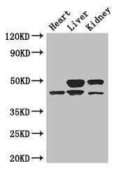 Western Blot | Positive WB detected in: Mouse heart tissue, Mouse liver tissue, Mouse kidney tissue | All lanes: TGIF1 antibody at 3μg/ml | Secondary | Goat polyclonal to rabbit IgG at 1/50000 dilution | Predicted band size: 44, 30, 32, 28 kDa | Observed band size: 44, 50 kDaRabbit anti-Human TGIF1 Polyclonal Antibody
