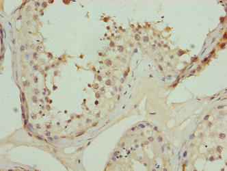 Immunohistochemistry of paraffin-embedded human testis tissue using the antibody at dilution of 1:100Rabbit anti-Human TRIP13 Polyclonal Antibody