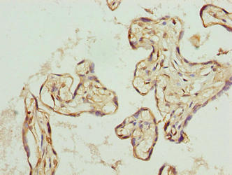 Immunohistochemistry of paraffin-embedded human placenta tissue using TRIP13 Antibody at dilution of 1:100Rabbit anti-Human TRIP13 Polyclonal Antibody