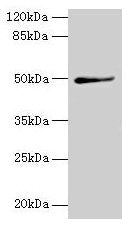 Western blot  | All lanes: TRIP13 antibody at 1µg/ml + A549 whole cell lysate  | Secondary  | Goat polyclonal to rabbit IgG at 1/10000 dilution  | Predicted band size: 49, 23 kDa  | Observed band size: 49 kDaRabbit anti-Human TRIP13 Polyclonal Antibody