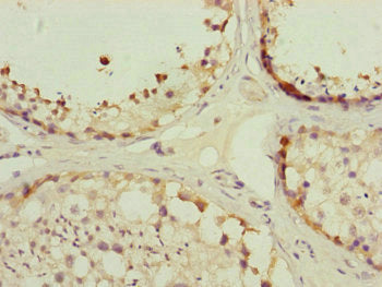 Immunohistochemistry of paraffin-embedded human testis tissue using TOMM34 Antibody at dilution of 1:100Rabbit anti-Human TOMM34 Polyclonal Antibody