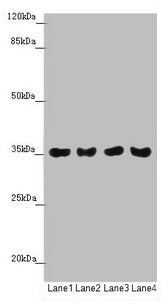 Western blot  | All lanes: TOMM34 antibody at 1.42µg/ml  | Lane 1: Mouse gonadal tissue  | Lane 2: A549 whole cell lysate  | Lane 3: PC-3 whole cell lysate  | Lane 4: A375 whole cell lysate  | Secondary  | Goat polyclonal to rabbit IgG at 1/10000 dilution  | Predicted band size: 35 kDa  | Observed band size: 35 kDaRabbit anti-Human TOMM34 Polyclonal Antibody