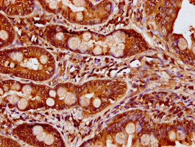IHC image of CCDC6 Antibody diluted at 1:500 and staining in paraffin-embedded human small intestine tissue performed on a Leica BondTM system. After dewaxing and hydration, antigen retrieval was mediated by high pressure in a citrate buffer (pH 6.0). Section was blocked with 10% normal goat serum 30min at RT. Then primary antibody (1% BSA) was incubated at 4°C overnight. The primary is detected by a biotinylated secondary antibody and visualized using an HRP conjugated SP system.