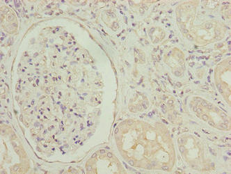 Immunohistochemistry of paraffin-embedded human kidney tissue using SGCA Antibody at dilution of 1:100Rabbit anti-Human SGCA Polyclonal Antibody
