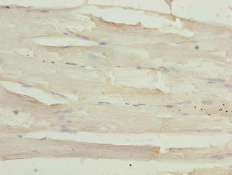 Immunohistochemistry of paraffin-embedded human skeletal muscle tissue using SGCA Antibody at dilution of 1:100Rabbit anti-Human SGCA Polyclonal Antibody