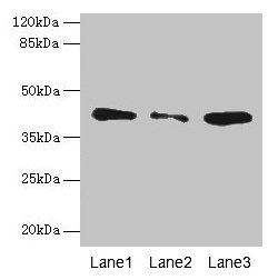 Western blot  | All lanes: SGCA antibody at 0.5µg/ml  | Lane 1: Jurkat whole cell lysate  | Lane 2: HepG2 whole cell lysate  | Lane 3: 293T whole cell lysate  | Secondary  | Goat polyclonal to rabbit IgG at 1/10000 dilution  | Predicted band size: 43, 30 kDa  | Observed band size: 43 kDaRabbit anti-Human SGCA Polyclonal Antibody