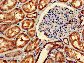 Immunohistochemistry of paraffin-embedded human kidney tissue using IMMT Antibody at dilution of 1:100Rabbit anti-Human IMMT Polyclonal Antibody