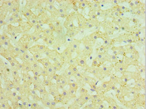 Immunohistochemistry of paraffin-embedded human liver tissue using HYAL1 Antibody at dilution of 1:100