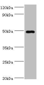 Western blot  | All lanes: HYAL1 antibody at 2µg/ml + HepG2 whole cell lysate  | Secondary  | Goat polyclonal to rabbit IgG at 1/10000 dilution  | Predicted band size: 49, 46, 28, 24, 20, 11, 38 kDa  | Observed band size: 49 kDa