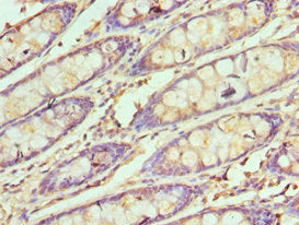 Immunohistochemistry of paraffin-embedded human colon tissue using SMARCB1 Antibody at dilution of 1:100Rabbit anti-Human SMARCB1 Polyclonal Antibody