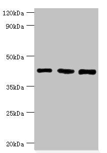 Western blot | All lanes: SWI/SNF-related matrix-associated actin-dependent regulator of chromatin subfamily B member 1 antibody at 8μg/ml | Lane 1: Hela whole cell lysate | Lane 2: 293T whole cell lysate | Lane 3: Mouse stomach tissue | Secondary | Goat polyclonal to rabbit IgG at 1/10000 dilution | Predicted band size: 45, 44 kDa | Observed band size: 45 kDaRabbit anti-Human SMARCB1 Polyclonal Antibody