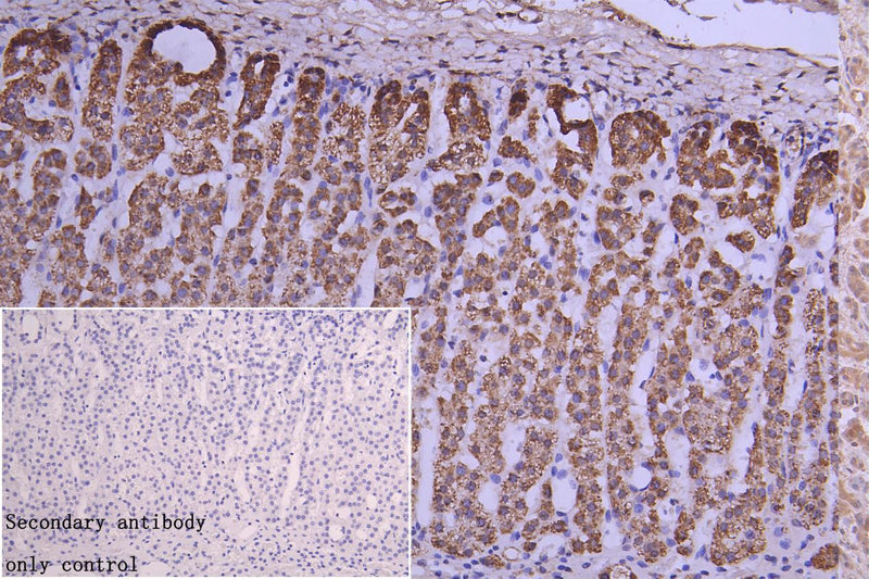 Immunohistochemistry of paraffin-embedded human adrenal gland tissue using CRHR2 Antibody at dilution of 1:100Rabbit anti-Human CRHR2 Polyclonal Antibody