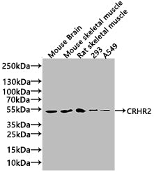 Western Blot | Positive WB detected in: Rat brain tissue, Mouse brain tissue | All lanes: CRHR2 antibody at 3μg/ml | Secondary | Goat polyclonal to rabbit IgG at 1/50000 dilution | Predicted band size: 48, 51, 47, 45, 43 kDa | Observed band size: 34 kDaRabbit anti-Human CRHR2 Polyclonal Antibody