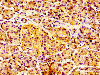 Immunohistochemistry of paraffin-embedded human pancreatic tissue using IL18R1 Antibody at dilution of 1:100