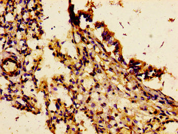 Immunohistochemistry of paraffin-embedded human lung tissue using IL18R1 Antibody at dilution of 1:100