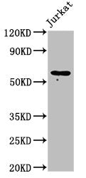 Western Blot  | Positive WB detected in: Jurkat whole cell lysate  | All lanes: IL18R1 antibody at 2µg/ml  | Secondary  | Goat polyclonal to rabbit IgG at 1/50000 dilution  | Predicted band size: 63 kDa  | Observed band size: 63 kDa