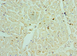 Immunohistochemistry of paraffin-embedded human heart tissue using TDG Antibody at dilution of 1:100Rabbit anti-Human TDG Polyclonal Antibody