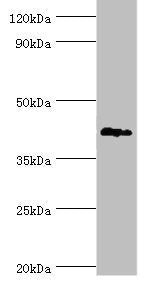 Western blot | All lanes: G/T mismatch-specific thymine DNA glycosylase antibody at 6μg/ml + Mouse brain tissue | Secondary | Goat polyclonal to rabbit IgG at 1/10000 dilution | Predicted band size: 46 kDa | Observed band size: 46 kDaRabbit anti-Human TDG Polyclonal Antibody