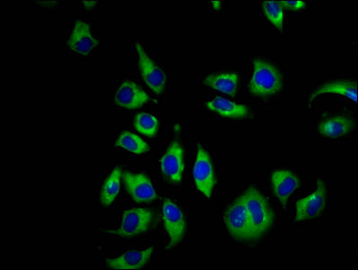 Immunofluorescence staining of A549 cells with CNGB1 Antibody at 1:66, counter-stained with DAPI. The cells were fixed in 4% formaldehyde, permeabilized using 0.2% Triton X-100 and blocked in 10% normal Goat Serum. The cells were then incubated with the antibody overnight at 4°C. The secondary antibody was Alexa Fluor 488-congugated AffiniPure Goat Anti-Rabbit IgG(H+L).Rabbit anti-Human CNGB1 Polyclonal Antibody