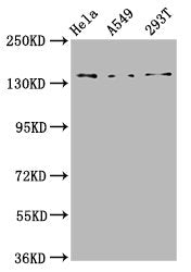 Western Blot  | Positive WB detected in: Hela whole cell lysate, A549 whole cell lysate, 293T whole cell lysate  | All lanes: CNGB1 antibody at 4.6µg/ml  | Secondary  | Goat polyclonal to rabbit IgG at 1/50000 dilution  | Predicted band size: 140, 71, 33 kDa  | Observed band size: 140 kDaRabbit anti-Human CNGB1 Polyclonal Antibody