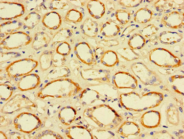 Immunohistochemistry of paraffin-embedded human kidney tissue using TFDP2 Antibody at dilution of 1:100Rabbit anti-Human TFDP2 Polyclonal Antibody
