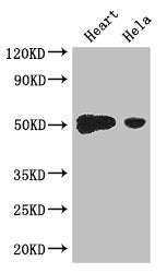 Western Blot | Positive WB detected in: Mouse heart tissue, Hela whole cell lysate | All lanes: TFDP2 antibody at 3.2μg/ml | Secondary | Goat polyclonal to rabbit IgG at 1/50000000 dilution | Predicted band size: 50, 41, 42, 43, 40, 35, 47 kDa | Observed band size: 50 kDaRabbit anti-Human TFDP2 Polyclonal Antibody