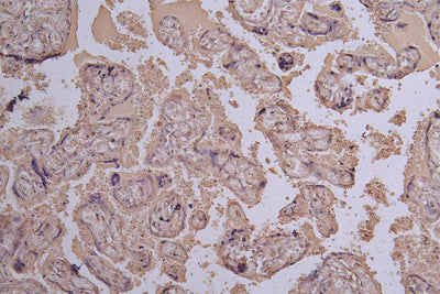 IHC image of  E2F2 Antibody diluted at 1:100 and staining in paraffin-embedded human placenta tissue performed on a Leica BondTM system. After dewaxing and hydration, antigen retrieval was mediated by high pressure in a citrate buffer (pH 6.0). Section was blocked with 10% normal goat serum 30min at RT. Then primary antibody (1% BSA) was incubated at 4°C overnight. The primary is detected by a Goat anti-rabbit polymer IgG labeled by HRP and visualized using 0.05% DAB.Rabbit anti-Human E2F2 Polyclonal Antibody