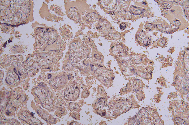 IHC image of  E2F2 Antibody diluted at 1:100 and staining in paraffin-embedded human placenta tissue performed on a Leica BondTM system. After dewaxing and hydration, antigen retrieval was mediated by high pressure in a citrate buffer (pH 6.0). Section was blocked with 10% normal goat serum 30min at RT. Then primary antibody (1% BSA) was incubated at 4°C overnight. The primary is detected by a Goat anti-rabbit polymer IgG labeled by HRP and visualized using 0.05% DAB.Rabbit anti-Human E2F2 Polyclonal Antibody