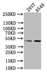 Western BlotPositive WB detected in: 293T whole cell lysate, A549 whole cell lysateAll lanes: E2F2 antibody at 1:1000SecondaryGoat polyclonal to rabbit IgG at 1/50000 dilutionPredicted band size: 48 kDaObserved band size: 48 kDaRabbit anti-Human E2F2 Polyclonal Antibody