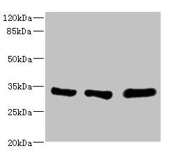 Western blot  | All lanes: EIF2B1 antibody at 5.14µg/ml  | Lane 1: K562 whole cell lysate  | Lane 2: Mouse brain tissue  | Lane 3: Jurkat whole cell lysate  | Secondary  | Goat polyclonal to rabbit IgG at 1/10000 dilution  | Predicted band size: 34, 25 kDa  | Observed band size: 34 kDaRabbit anti-Human EIF2B1 Polyclonal Antibody