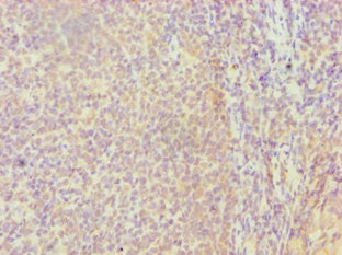 Immunohistochemistry of paraffin-embedded human tonsil tissue using FGFBP1 Antibody at dilution of 1:100Rabbit anti-Human FGFBP1 Polyclonal Antibody