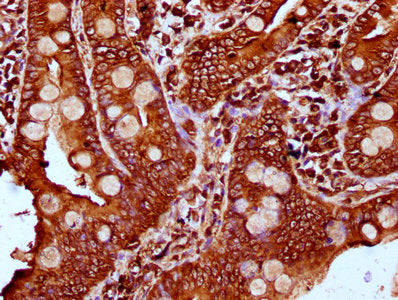 IHC image of PLS1 Antibody diluted at 1:400 and staining in paraffin-embedded human small intestine tissue performed on a Leica BondTM system. After dewaxing and hydration, antigen retrieval was mediated by high pressure in a citrate buffer (pH 6.0). Section was blocked with 10% normal goat serum 30min at RT. Then primary antibody (1% BSA) was incubated at 4°C overnight. The primary is detected by a biotinylated secondary antibody and visualized using an HRP conjugated SP system.Rabbit anti-Human PLS1 Polyclonal Antibody