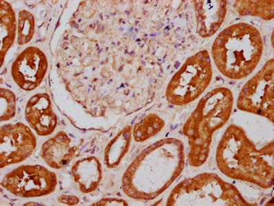 IHC image of PLS1 Antibody diluted at 1:400 and staining in paraffin-embedded human kidney tissue performed on a Leica BondTM system. After dewaxing and hydration, antigen retrieval was mediated by high pressure in a citrate buffer (pH 6.0). Section was blocked with 10% normal goat serum 30min at RT. Then primary antibody (1% BSA) was incubated at 4°C overnight. The primary is detected by a biotinylated secondary antibody and visualized using an HRP conjugated SP system.Rabbit anti-Human PLS1 Polyclonal Antibody