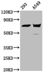 Western Blot  | Positive WB detected in: 293 whole cell lysate, A549 whole cell lysate  | All lanes: PLS1 antibody at 5.2µg/ml  | Secondary  | Goat polyclonal to rabbit IgG at 1/50000 dilution  | Predicted band size: 71 kDa  | Observed band size: 71 kDaRabbit anti-Human PLS1 Polyclonal Antibody