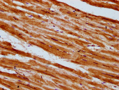IHC image of the antibody diluted at 1:300 and staining in paraffin-embedded human heart tissue performed on a Leica BondTM system. After dewaxing and hydration, antigen retrieval was mediated by high pressure in a citrate buffer (pH 6.0). Section was blocked with 10% normal goat serum 30min at RT. Then primary antibody (1% BSA) was incubated at 4°C overnight. The primary is detected by a biotinylated secondary antibody and visualized using an HRP conjugated SP system.Rabbit anti-Human PLCL1 Polyclonal Antibody