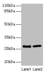 Western blot  | All lanes: EBP antibody at 2µg/ml  | Lane 1: A549 whole cell lysate  | Lane 2: 293T whole cell lysate  | Secondary  | Goat polyclonal to rabbit IgG at 1/10000 dilution  | Predicted band size: 27 kDa  | Observed band size: 27 kDaRabbit anti-Human EBP Polyclonal Antibody