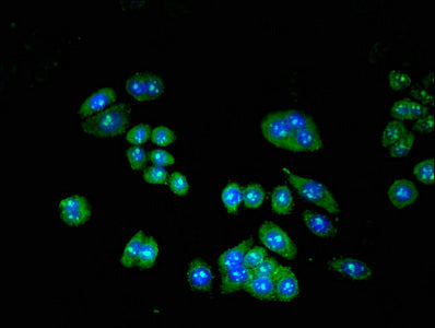 Immunofluorescent analysis of PC-3 cells using TRIP10 Antibody at dilution of 1:100 and Alexa Fluor 488-congugated AffiniPure Goat Anti-Rabbit IgG(H+L)Rabbit anti-Human TRIP10 Polyclonal Antibody