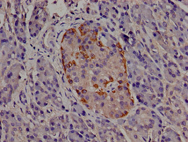Immunohistochemistry of paraffin-embedded human pancreatic tissue using the antibody at dilution of 1:100Rabbit anti-Human TRIP10 Polyclonal Antibody
