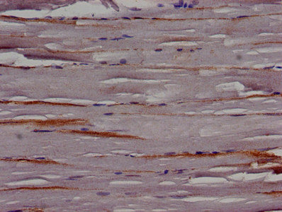 Immunohistochemistry of paraffin-embedded human skeletal muscle tissue using TRIP10 Antibody at dilution of 1:100Rabbit anti-Human TRIP10 Polyclonal Antibody