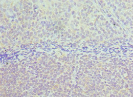 Immunohistochemistry of paraffin-embedded human tonsil tissue using TAB1 Antibody at dilution of 1:100Rabbit anti-Human TAB1 Polyclonal Antibody