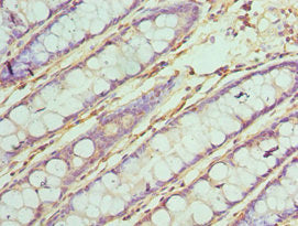 Immunohistochemistry of paraffin-embedded human colon tissue using TAB1 Antibody at dilution of 1:100Rabbit anti-Human TAB1 Polyclonal Antibody