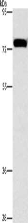 Gel: 10%SDS-PAGE, Lysate: 40 μg, Lane: Hela cells, Primary antibody: ALOX15 Antibody(ALOX15 Antibody) at dilution 1/1300, Secondary antibody: Goat anti rabbit IgG at 1/8000 dilution, Exposure time: 1 minuteRabbit anti-Human ALOX15 Polyclonal Antibody