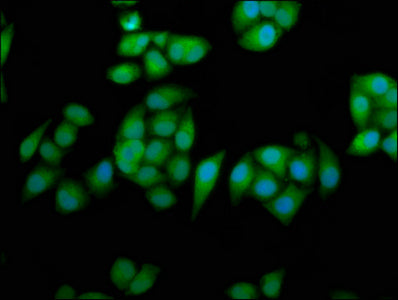 Immunofluorescence staining of Hela cells with RPE65 Antibody at 1:233, counter-stained with DAPI. The cells were fixed in 4% formaldehyde, permeabilized using 0.2% Triton X-100 and blocked in 10% normal Goat Serum. The cells were then incubated with the antibody overnight at 4°C. The secondary antibody was Alexa Fluor 488-congugated AffiniPure Goat Anti-Rabbit IgG(H+L).Rabbit anti-Human RPE65 Polyclonal Antibody