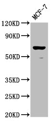 Western Blot | Positive WB detected in: MCF-7 whole cell lysate | All lanes: RPE65 antibody at 1:2000 | Secondary | Goat polyclonal to rabbit IgG at 1/50000 dilution | Predicted band size: 61 kDa | Observed band size: 61 kDaRabbit anti-Human RPE65 Polyclonal Antibody