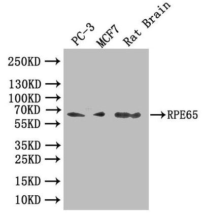 Western Blot | Positive WB detected in: Rat brain tissue | All lanes: RPE65 antibody at 2.3μg/ml | Secondary | Goat polyclonal to rabbit IgG at 1/50000 dilution | Predicted band size: 61 kDa | Observed band size: 61 kDaRabbit anti-Human RPE65 Polyclonal Antibody