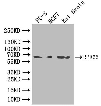 Western Blot | Positive WB detected in: Rat brain tissue | All lanes: RPE65 antibody at 2.3μg/ml | Secondary | Goat polyclonal to rabbit IgG at 1/50000 dilution | Predicted band size: 61 kDa | Observed band size: 61 kDaRabbit anti-Human RPE65 Polyclonal Antibody